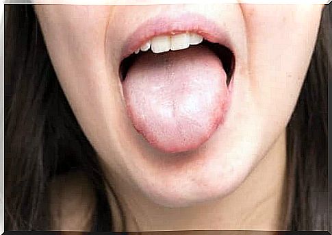 The antimicrobial properties of cloves improve overall oral health, help prevent and treat oral infections and fight bad breath, as the woman with tongue out of mouth illustrates