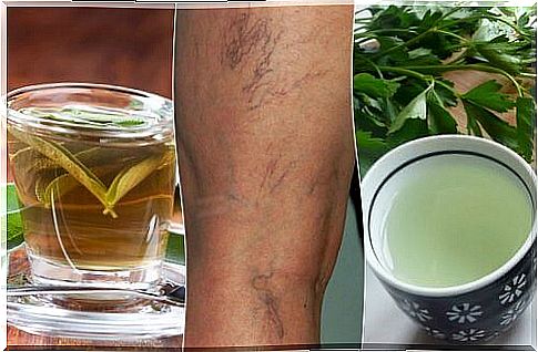 5 more diuretic teas if you suffer from varicose veins