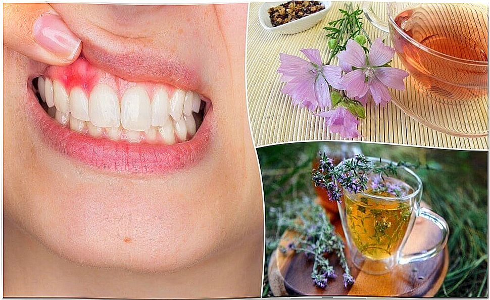 5 Natural Remedies To Fight Gingivitis