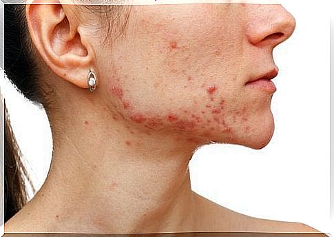 Woman who has rash on face