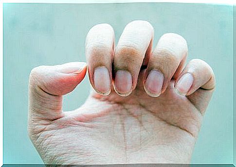 Weak nails as a sign of intestinal problems