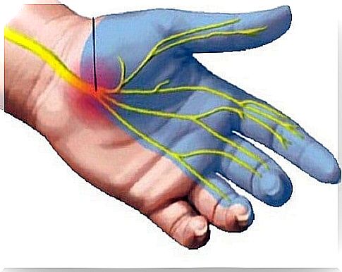 7 means to relieve carpal tunnel syndrome