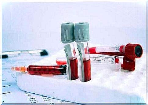 Blood tests can help determine medicines to treat anemia