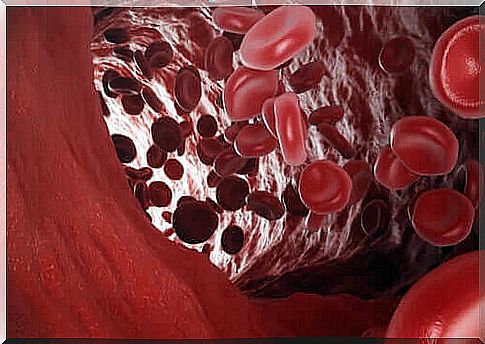 Red blood cells in blood vessels show carbon monoxide poisoning