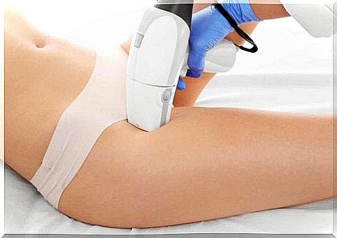 A woman gets hair removal done