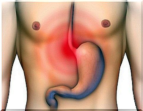 Heartburn or stomach acid?  What is the difference?