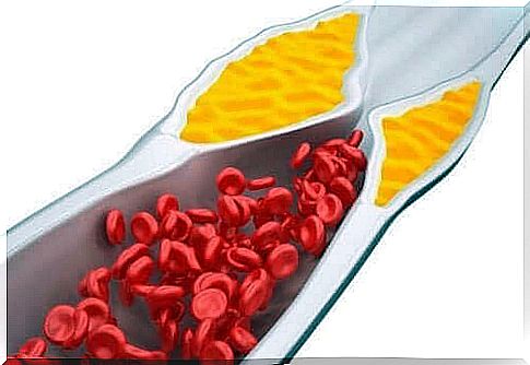 Cholesterol in the blood