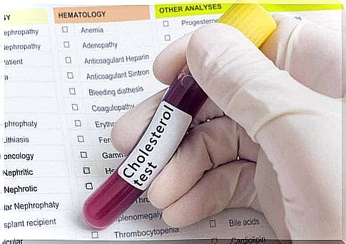 Blood test to measure the result of a cholesterol-lowering diet