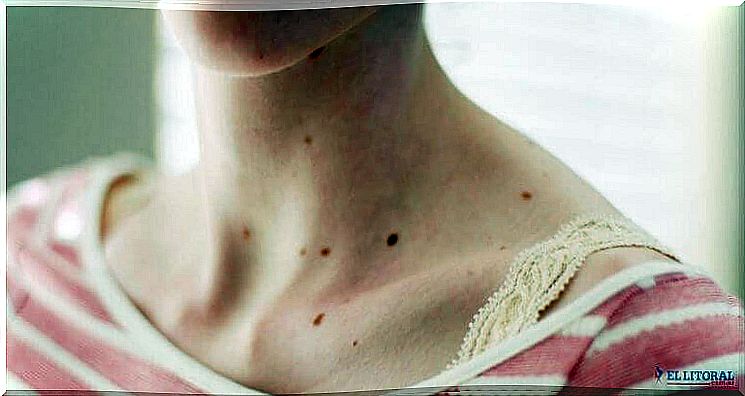 Woman with red spots.