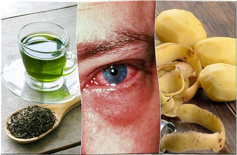 The 8 best remedies for eye inflammation