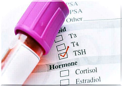 The causes of low thyroid stimulating hormone